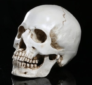 Interpreting Skull Fractures and Their Causes